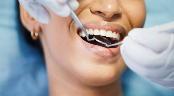 Best Emergency Treatment for Dental Infections or Abscesses in Hatch, NM